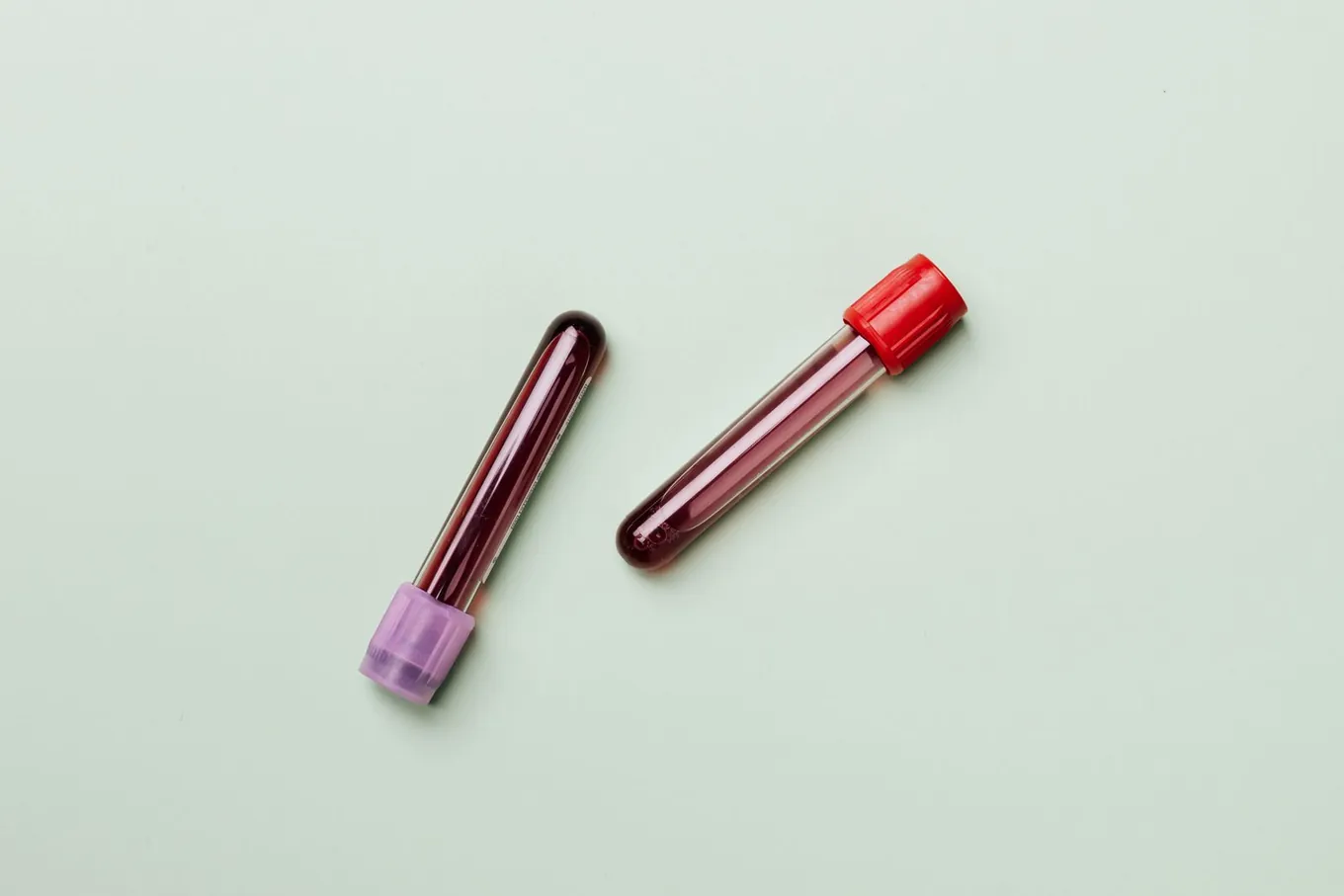 Ask for the specific tests by name so the panel matches the athlete you are Two blood sample collection tubes on a clinical background