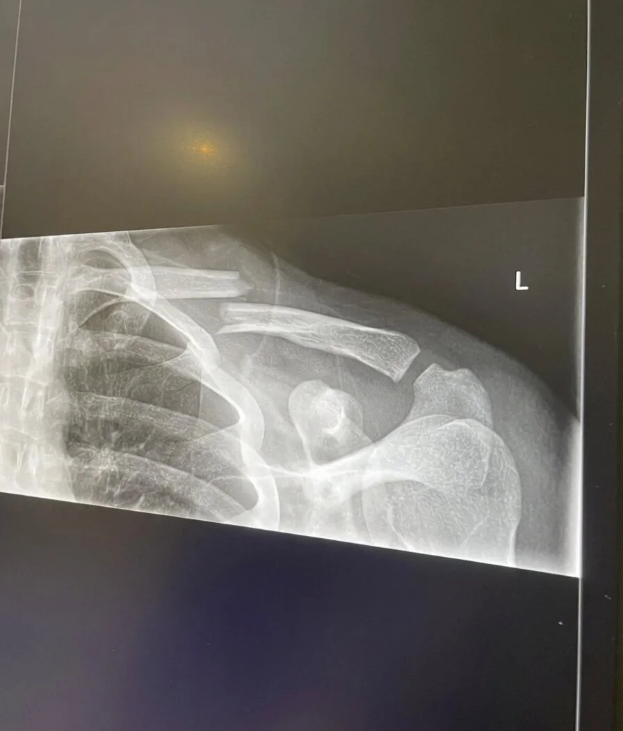 common cycling injuries common cycling injuries